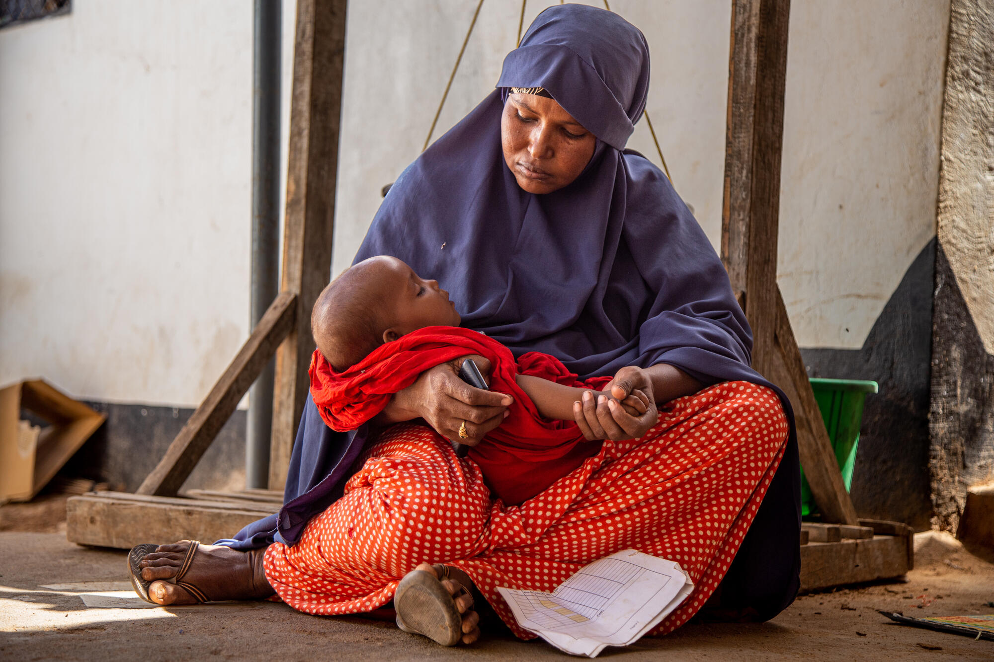 A mother holds her malnourished baby
